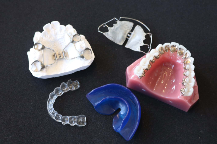様々な小児矯正器具のイメージ