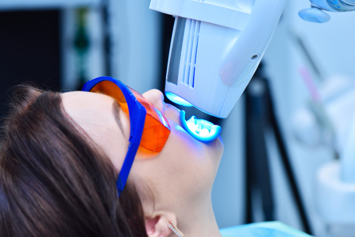 審美歯科治療の一環としてホワイトニング治療を受けている女性