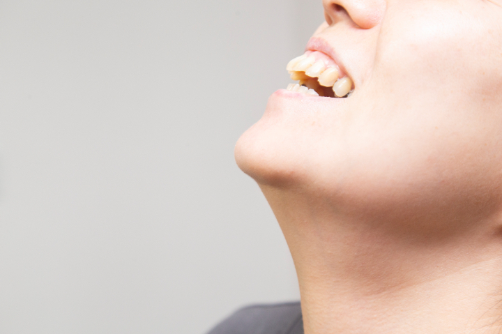 出っ歯の人の横顔